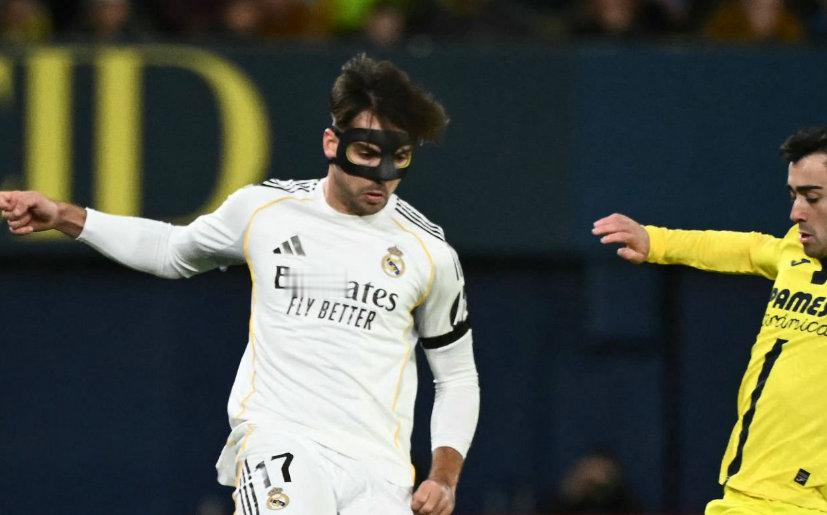 阿森西奥在比赛过程中已经把防护面具摘下了😳西甲联赛 比利亚雷亚尔VS皇马 ha