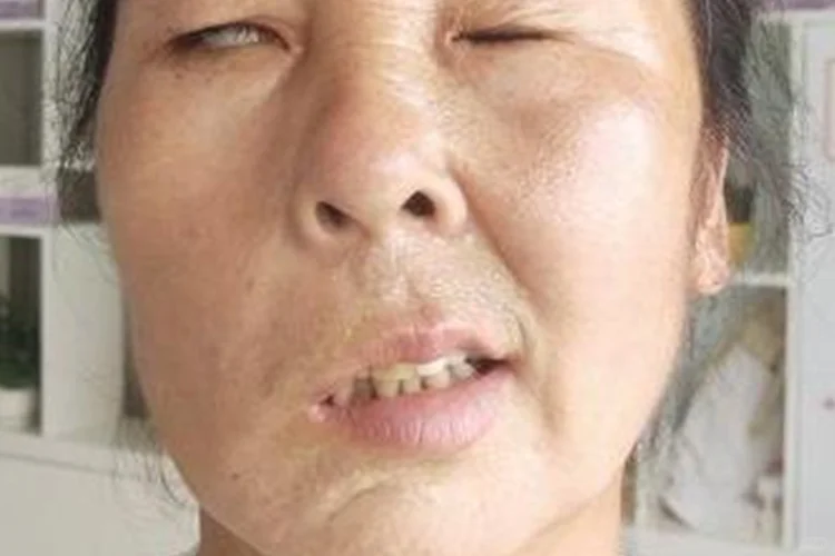 脸歪严重图片