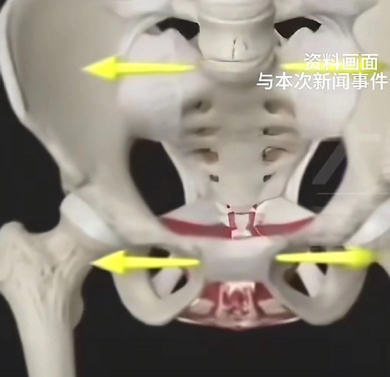 到底是什么原因才导致20岁的年龄已经有了60岁的身体？
浙江宁波一位20多岁的女