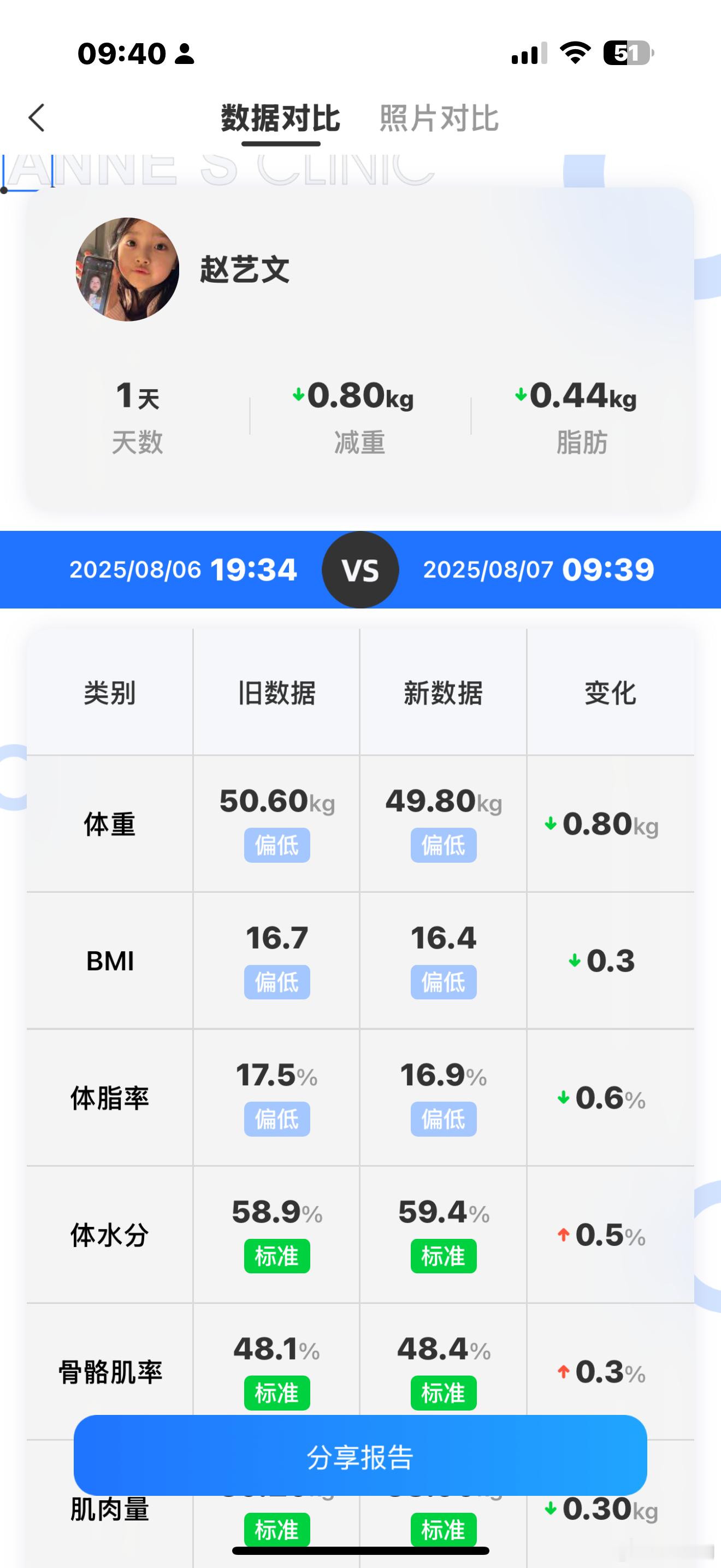 昨天就喝了两碗粥 洗脸都在拉伸[跪了]你就掉这么点 ​​​