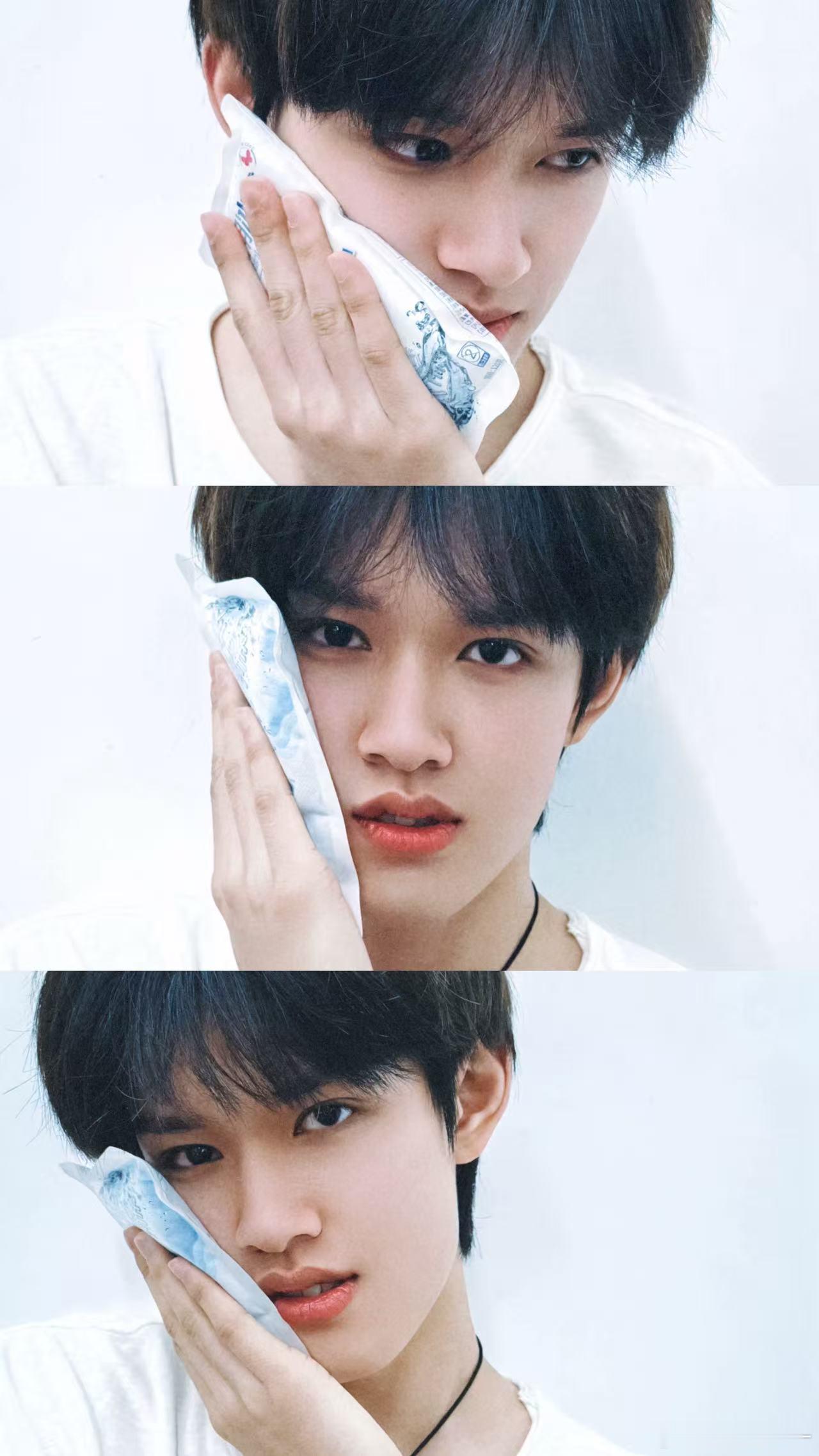 张极拔智齿了 拔牙真的很折磨人，张极还那么紧张，术后还不舒服，真的太不容易了，一