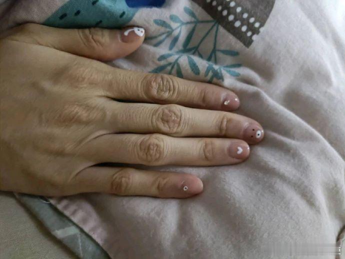 人丑真的连细节都是丑的 