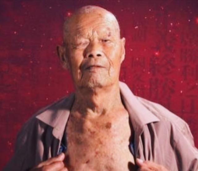 1956年，35岁农民咳嗽10年，竟拒绝就医，一天，他突然用力咳嗽，“哇”的一声