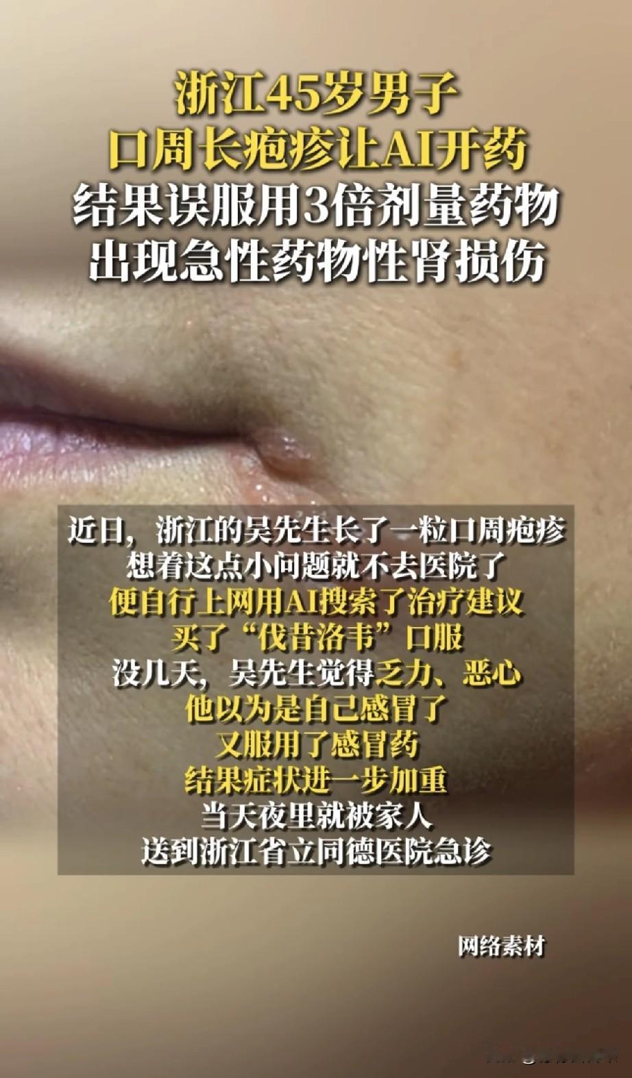 AI看病一句话，差点让他肾报废。
浙江吴先生只是嘴角长了个疱疹，他图省事用AI问