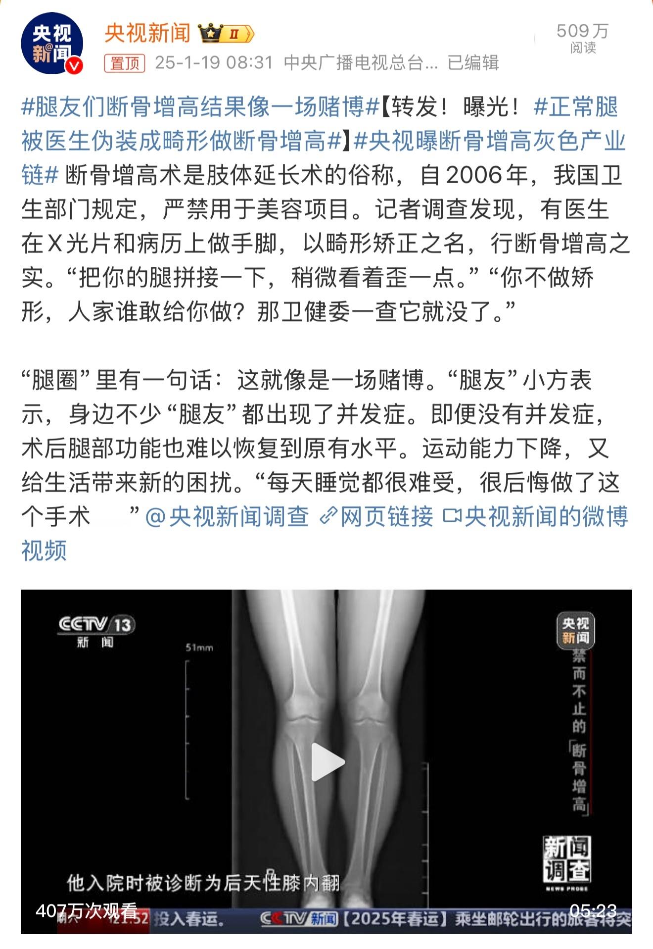 断骨增高，顾名思义就是把你的骨头打断之后再拼接上。这其实就是把一条好腿刻意打断，