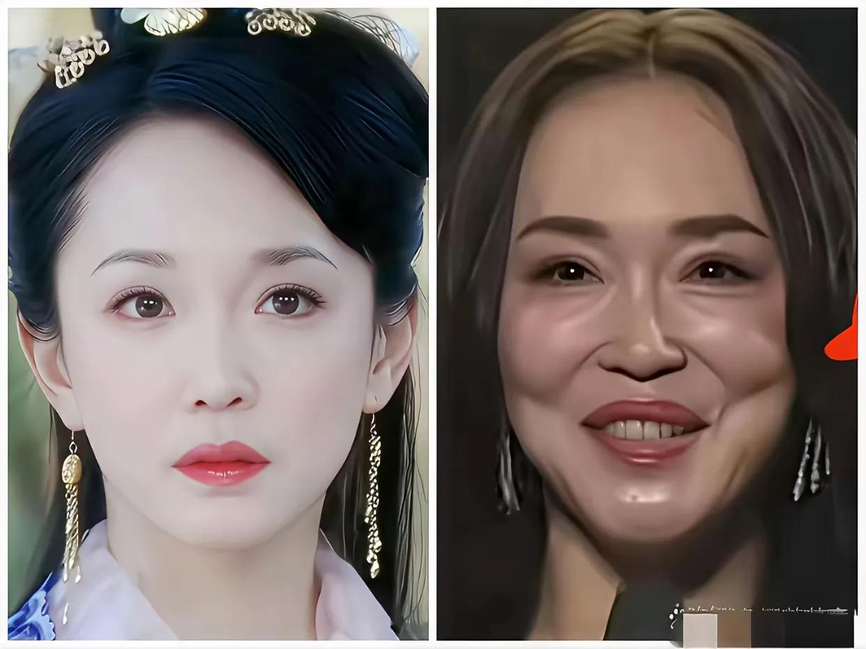 素颜的她们本来长相甜美气质如兰，不知道为什么一整变得这样收看了呢？
她们的变化。