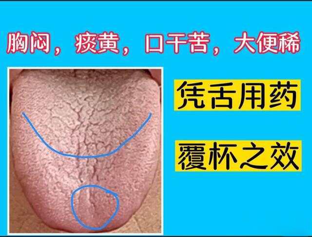什么是厥阴病？厥阴病为什么那么难治？

医圣化繁为简，把各种复杂病简单归为6种：