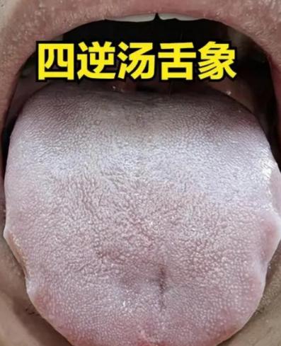 三味中药让海绵体从萎靡变的生龙活虎，活力满满！

门诊有很多患者都是海绵体功能下