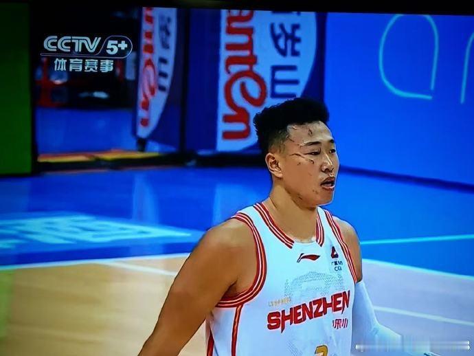 贺希宁都被打破相了，CBA鼓励泼妇挠人，裁判已经无法无天

广东输球，邱彪掀桌子