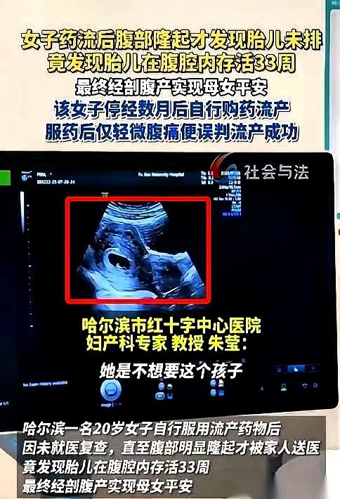 我跟你说个事儿，哈尔滨一个20岁的姑娘，吃药想把孩子打掉。
 
因担心家人责备，