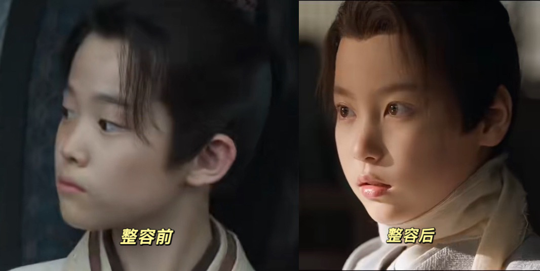 藏海割了双眼皮我笑死了 ​​​