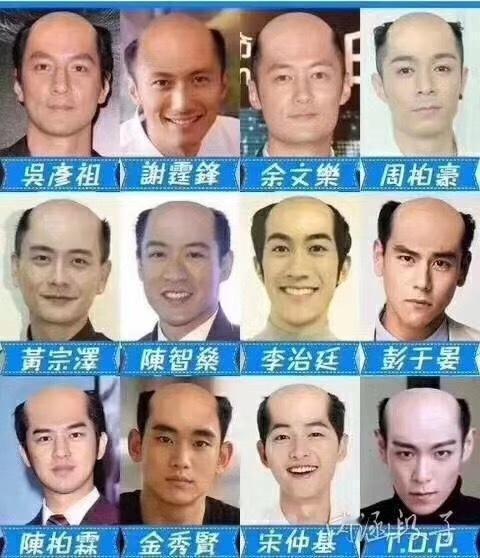 头发不在五官之列，可秀发对于一个人的颜值，还是占绝大部分！五官再英俊，五官再帅气