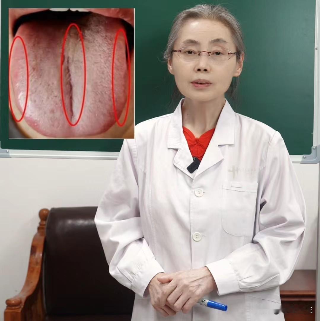 肝郁严重，但是用柴胡疏肝丸没有什么效果，这是怎么回事呢？其实答案都在你的舌头上。