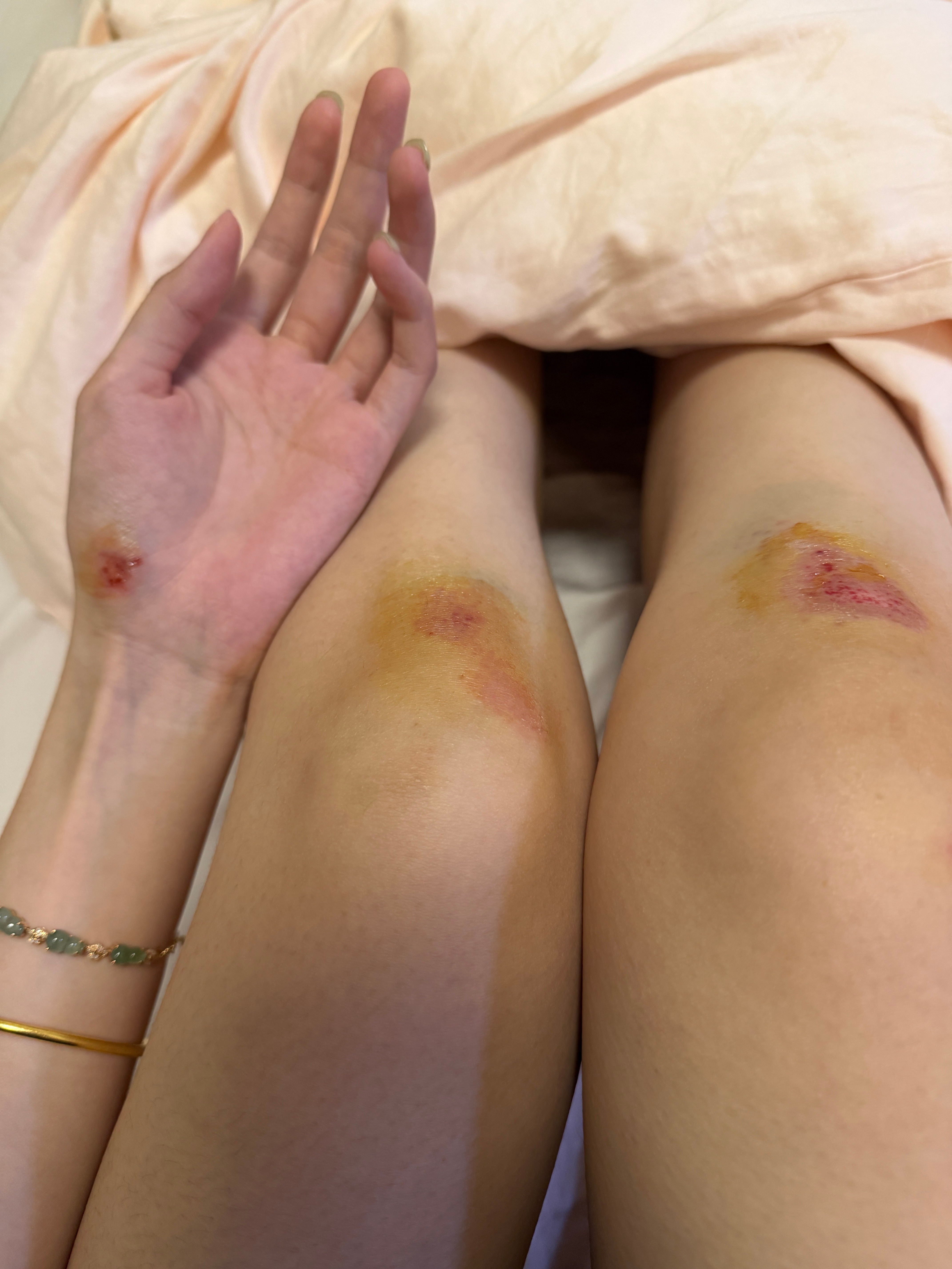 倒霉日记持续上演 ​​​