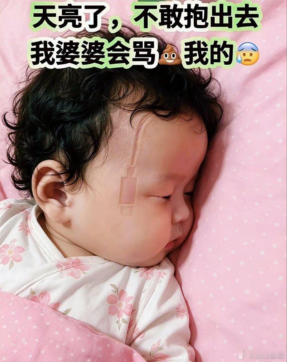 怎么办，多久能消啊？？急 ​​​