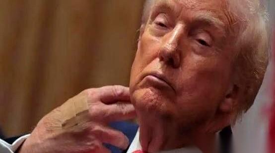 79岁的特朗普，身家525个亿，对着福克斯新闻的镜头，第一次说了实话。
他说：“