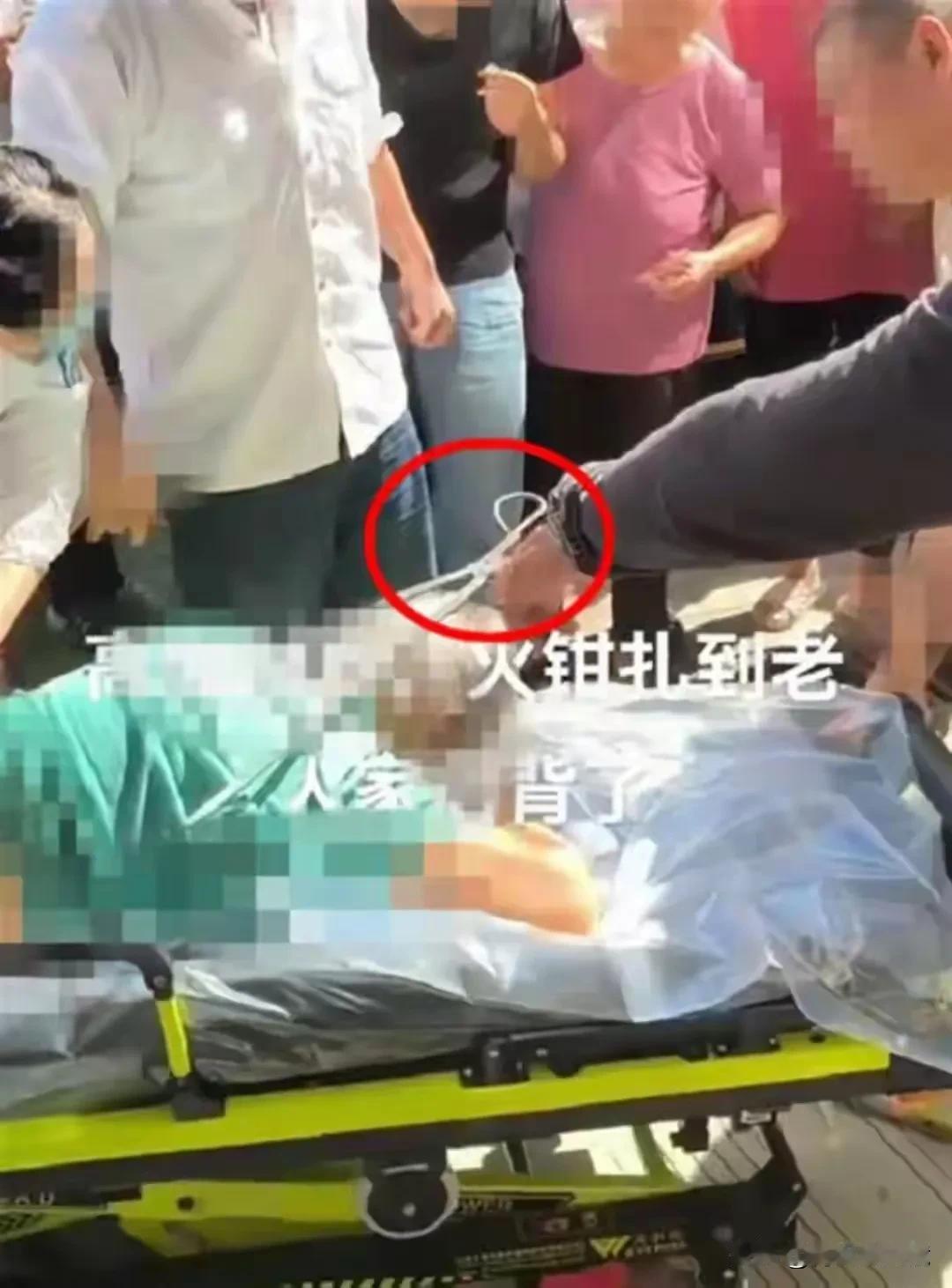 江苏南通阿婆遭高空坠物火钳扎伤后不幸去世

9月27日，江苏南通崇川区天生港镇街
