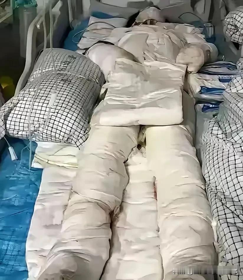 女人被硫酸烧成重伤，就因为她骗光了男友的钱，提出分手，男朋友要求退还彩礼等，所花