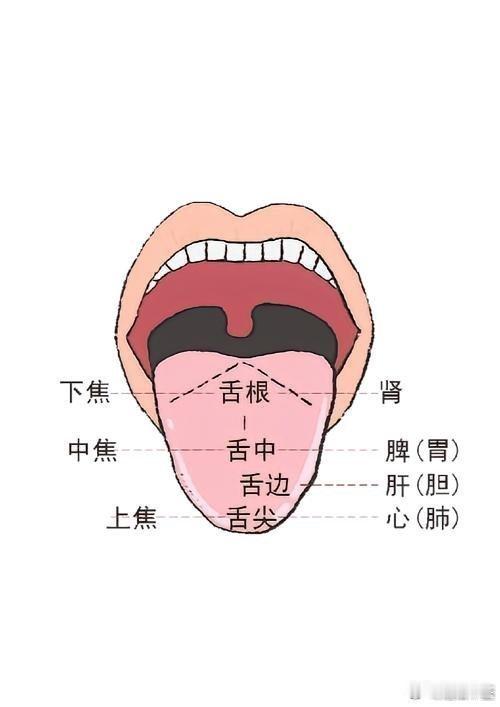 中医舌诊精髓：1，舌面哪里凸起，哪里有实证，或结节、或息肉、或囊肿；2，舌尖看心