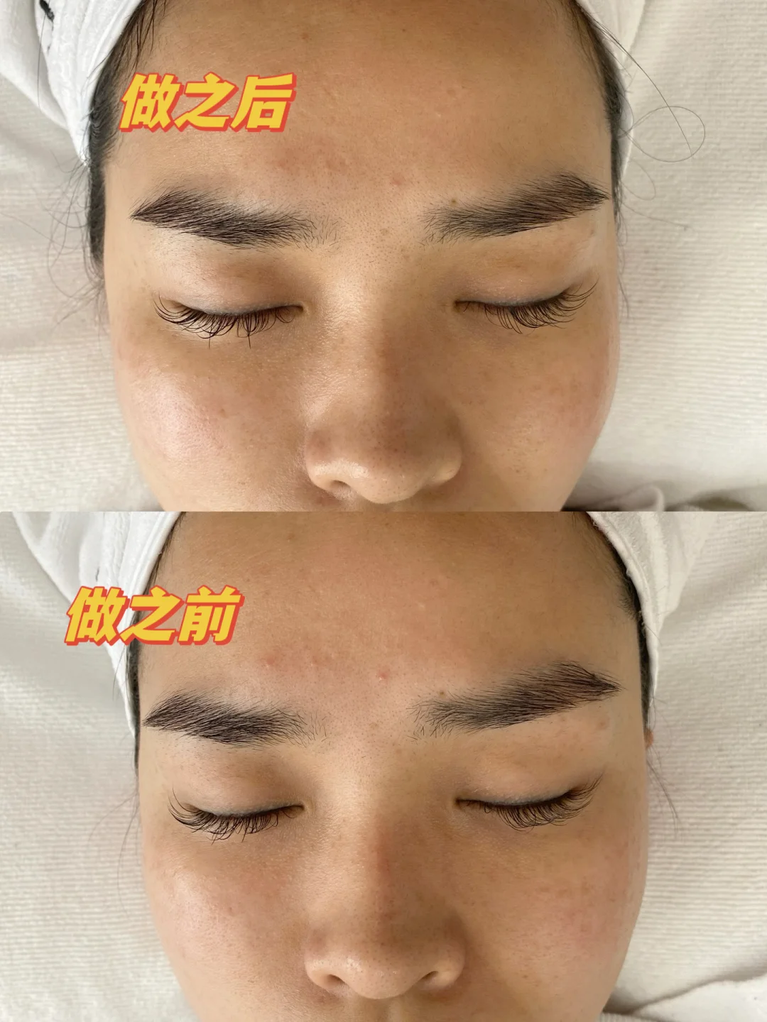 后悔发现晚了 | 美容界的黑科技