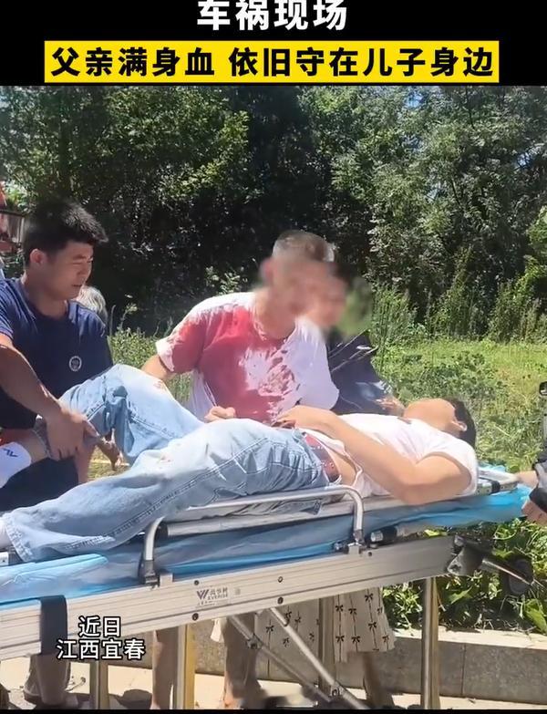 车祸现场满身是血的父亲不顾自己受伤一直守在儿子身边！这就是舐犊情深，这就是父爱如