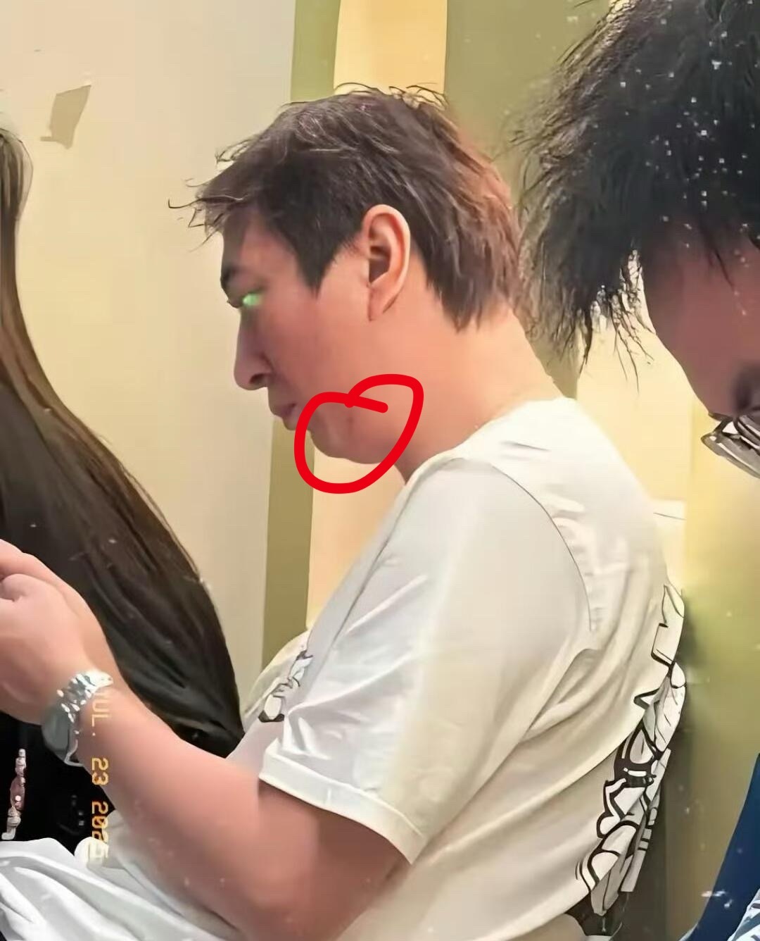 早就有人说过了王思聪这个不做正颌， 老年抢救容易插管都插不进去 ​​​