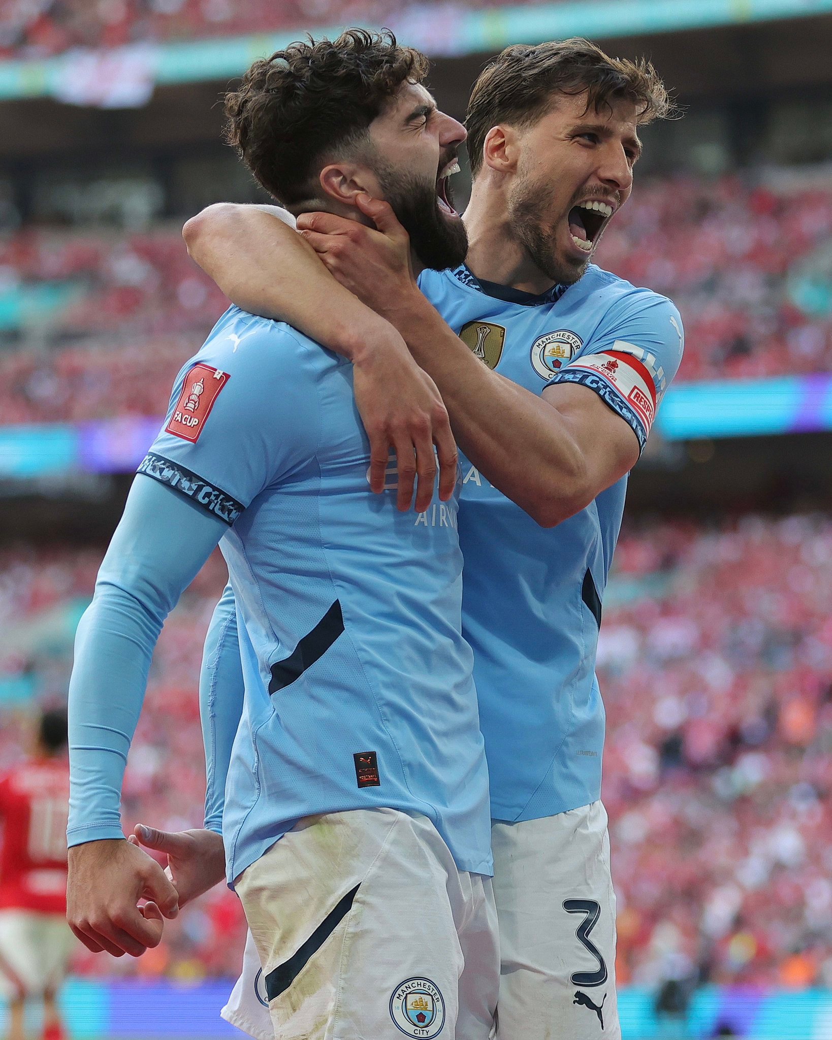 这一场恶战 曼城战损两名大将 迪亚斯也因伤缺席六周阿森纳那边得笑死。。。 