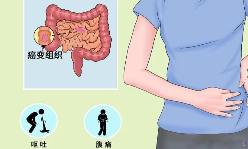  虽然这类热搜话题可能会让部分朋友不适。但了解预防方法，防患于未然，还是很有必要