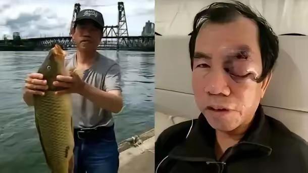 原来是一个华人老头在美国被打。这是A还是罗？