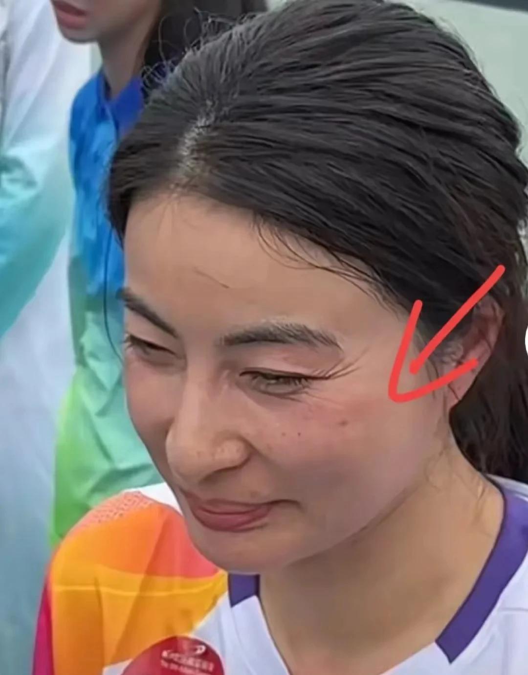 郭晶晶是真的没去医美，
内心太强大了！
一下子让我对各种贵妇面霜、眼霜失去购买欲