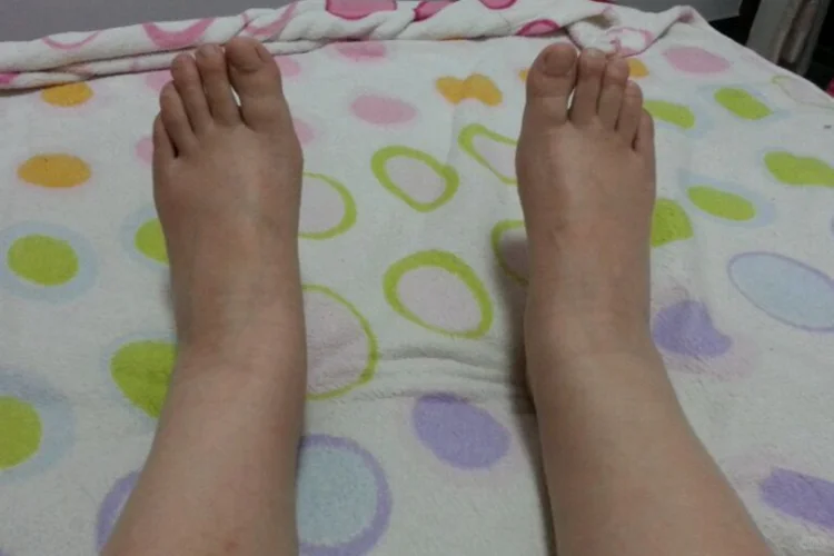 没有脚脖子是什么样的体验