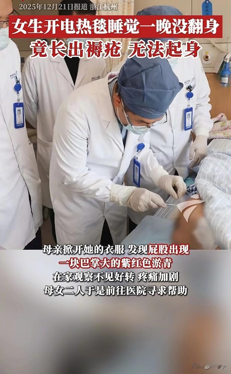 杭州21岁女生服用安眠药睡觉
开了一夜电热毯，第二天醒来屁股疼痛无法起身，竟然是