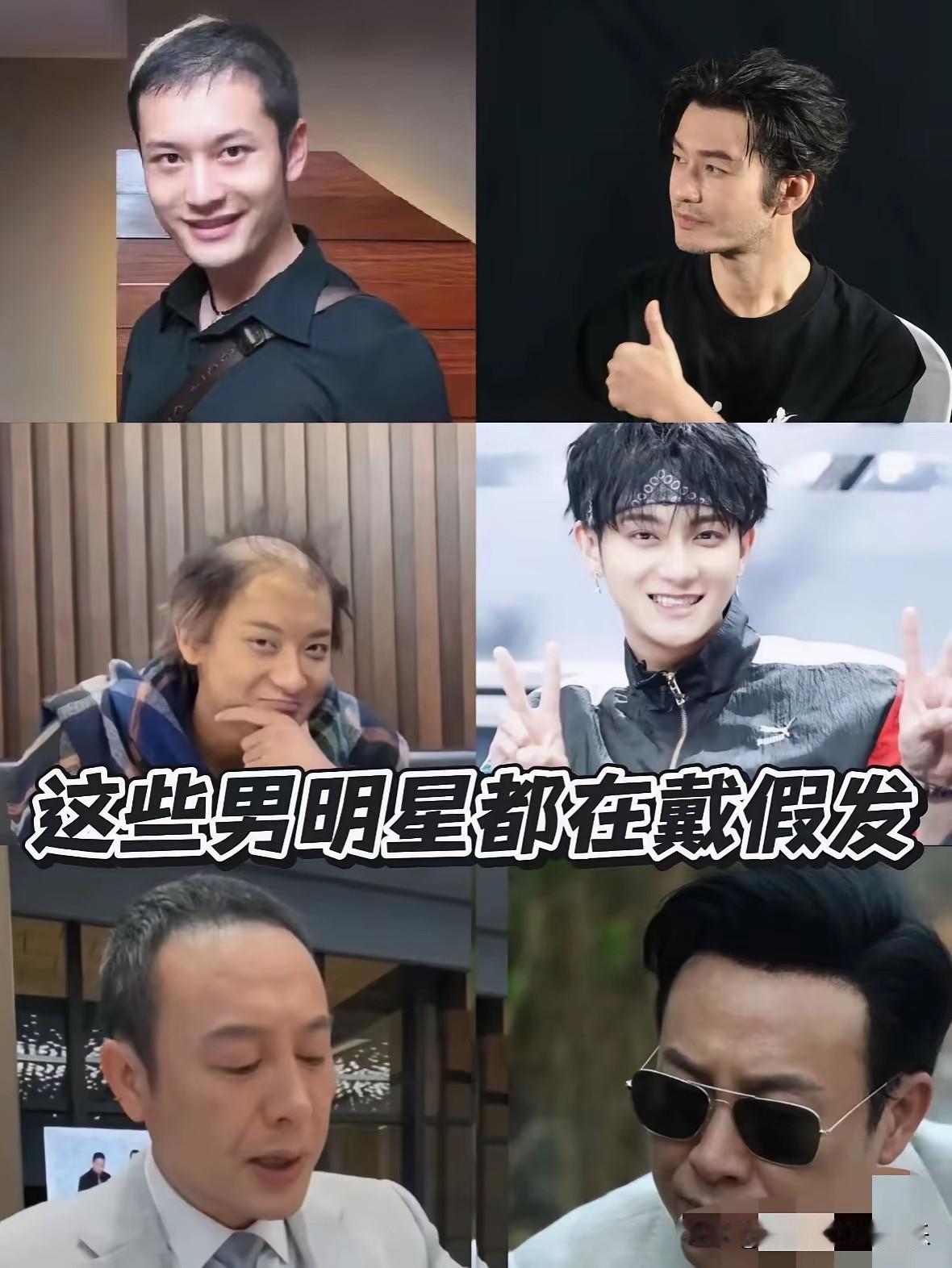 不是，这是真的假的？。他们都是秃头？白瞎我看了十几年电视！[捂脸]