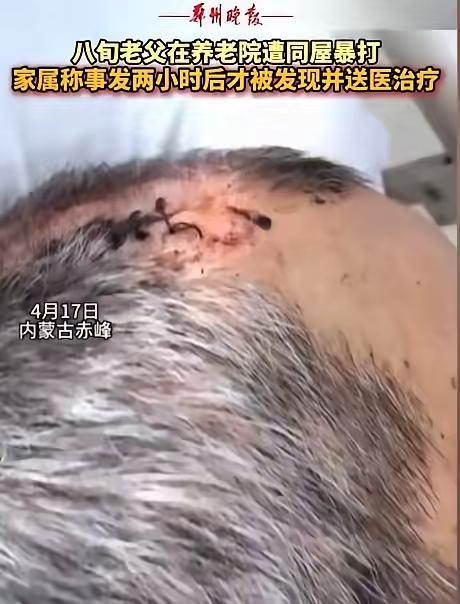 “必须严惩！”内蒙古赤峰，女子将丈夫送到养老院，几天后接丈夫，只见丈夫裤子直接裂