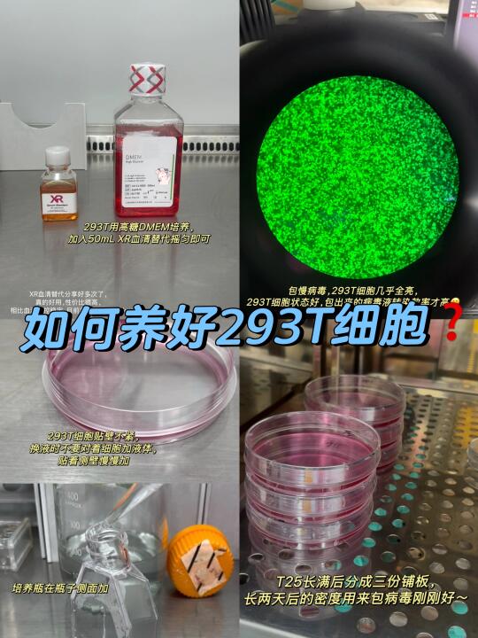 养好293T细胞是做好稳转的第一步❗