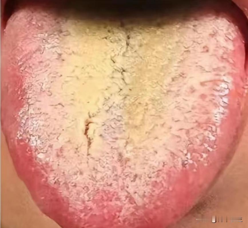 小便次数多，别只关注肾，出现这样的症状，也有可能是膀胱的问题

今天看诊了一位患
