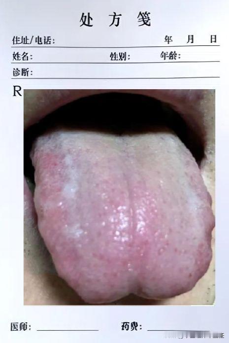 看着是肝郁脾虚，吃逍遥丸没用？那是你忽略了关键一点！

患者的主要问题是胸闷气短