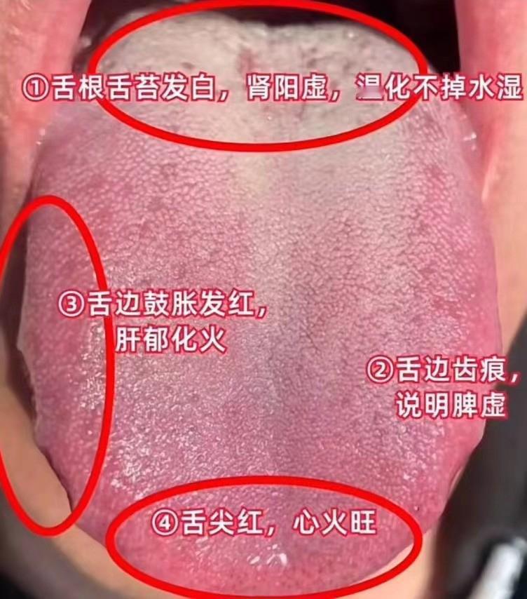 国庆已复工，今天挑战舌象第5天！
你发我看，直出结果！只要发，我就看！

要求还