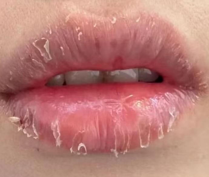 身体里边有什么毛病，看一眼嘴唇全知道！

1.嘴唇淡白——气血两虚
原因：气血不
