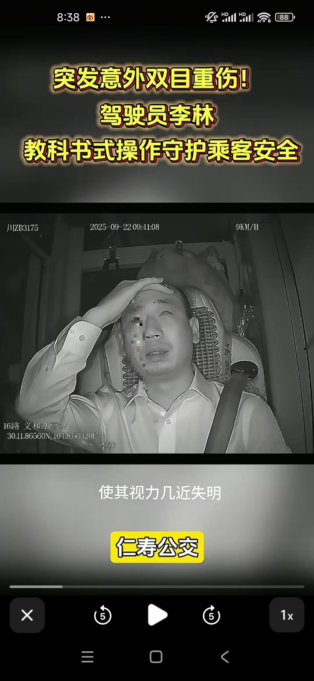真不敢想满眼碎玻璃碴还要眯眼努力看清路得有多疼！四川仁寿公交司机李林师傅真是条汉