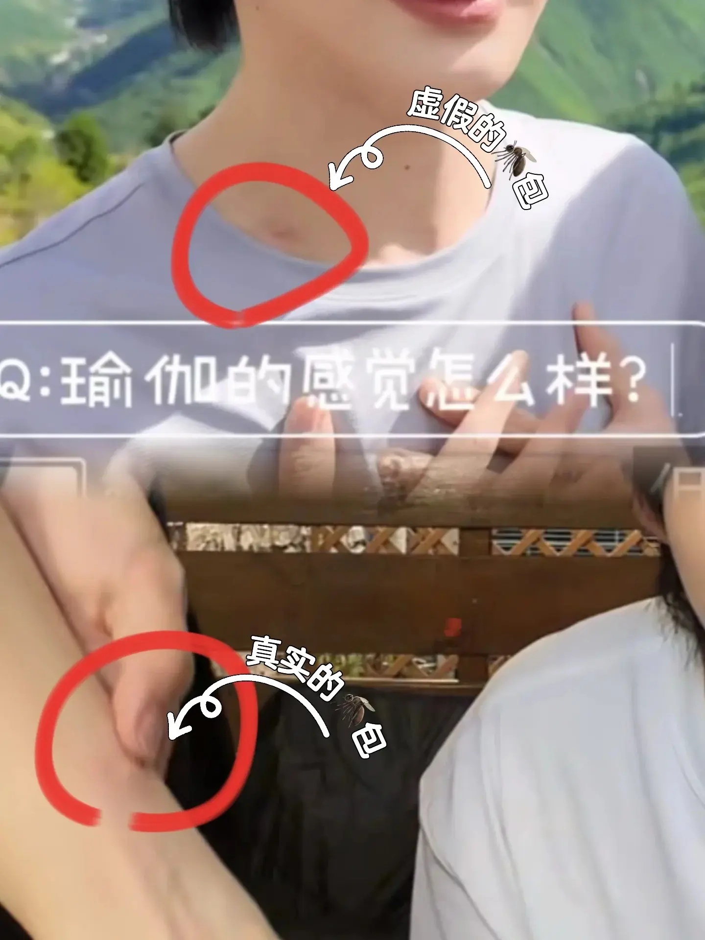 🦟：请为我发声 