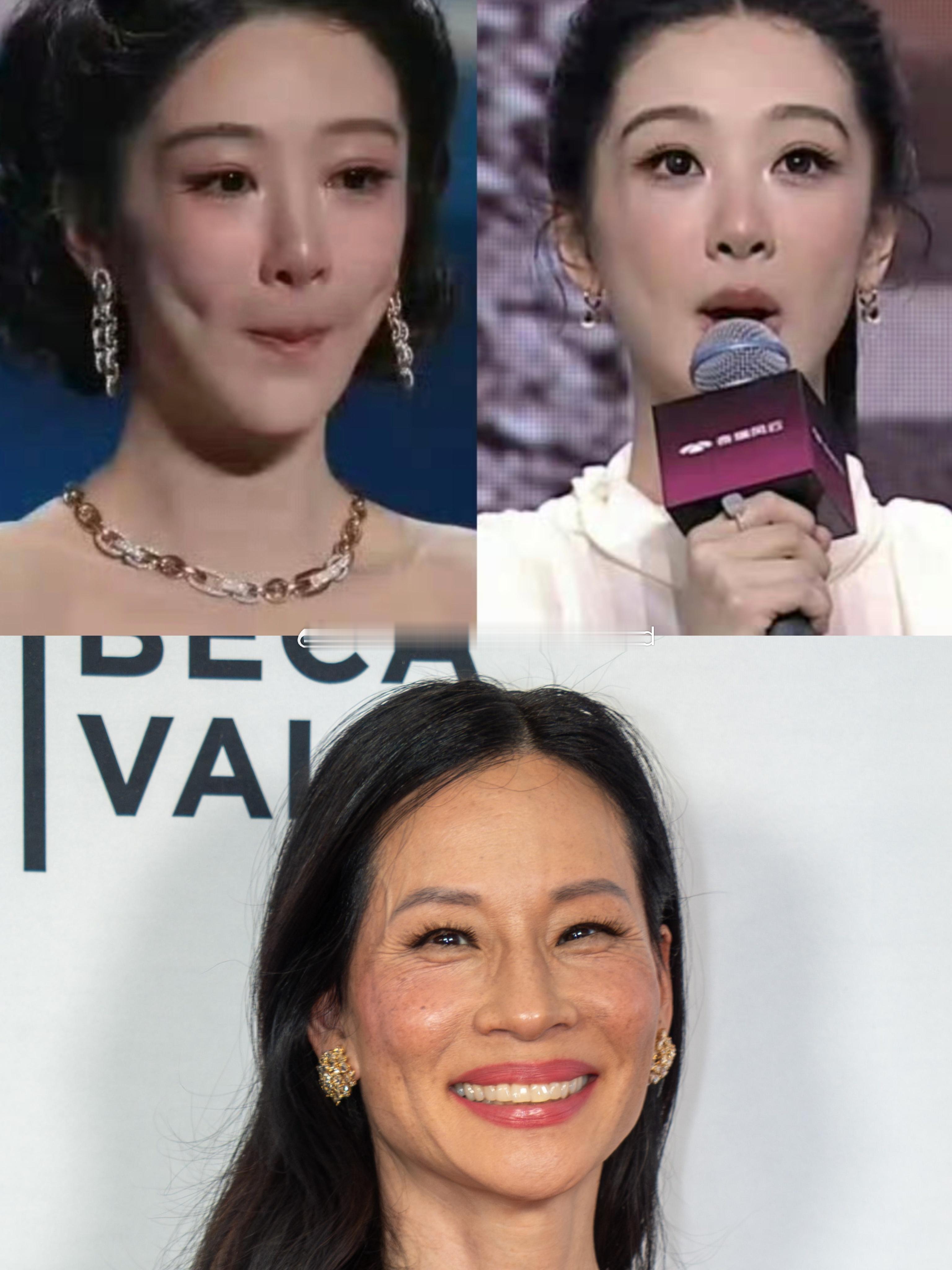 视后最近夫妻宫也是凹陷的，而且出现了一整条的凹槽，事业“高歌”但其他方面则可能堪