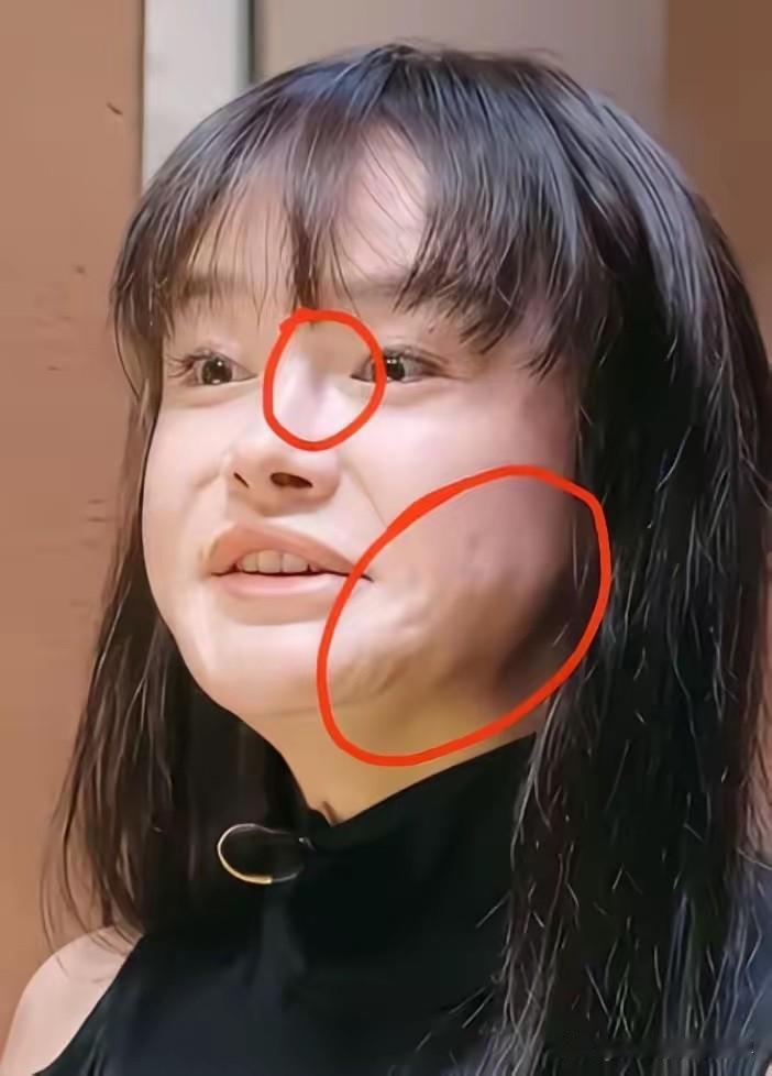 有时候实在是搞不懂冉莹颖，做生意投资亏损两个多亿，为什么就不能花点钱给自己做个医