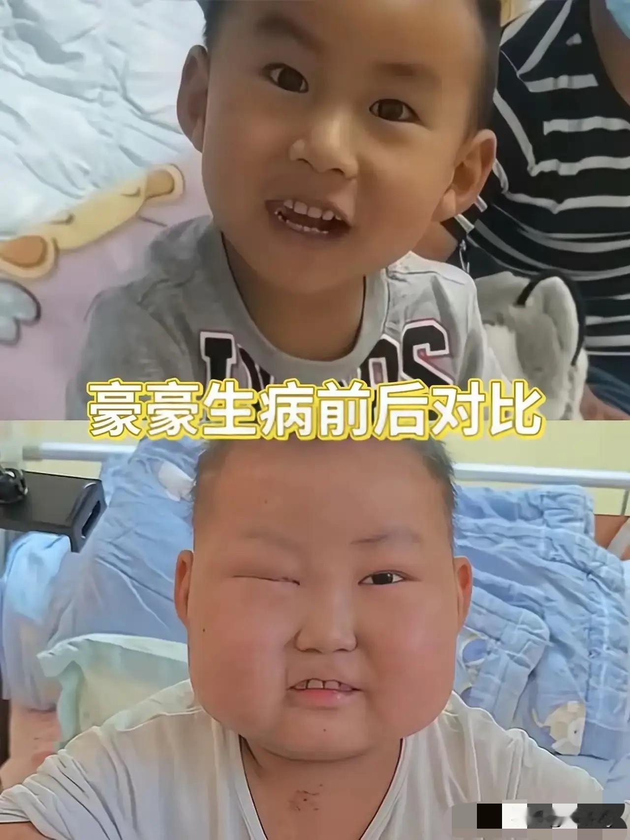 坚强的小王子豪豪还是离开了！

坚持了六年，只要清醒的时候，都会安慰爸爸妈妈不要