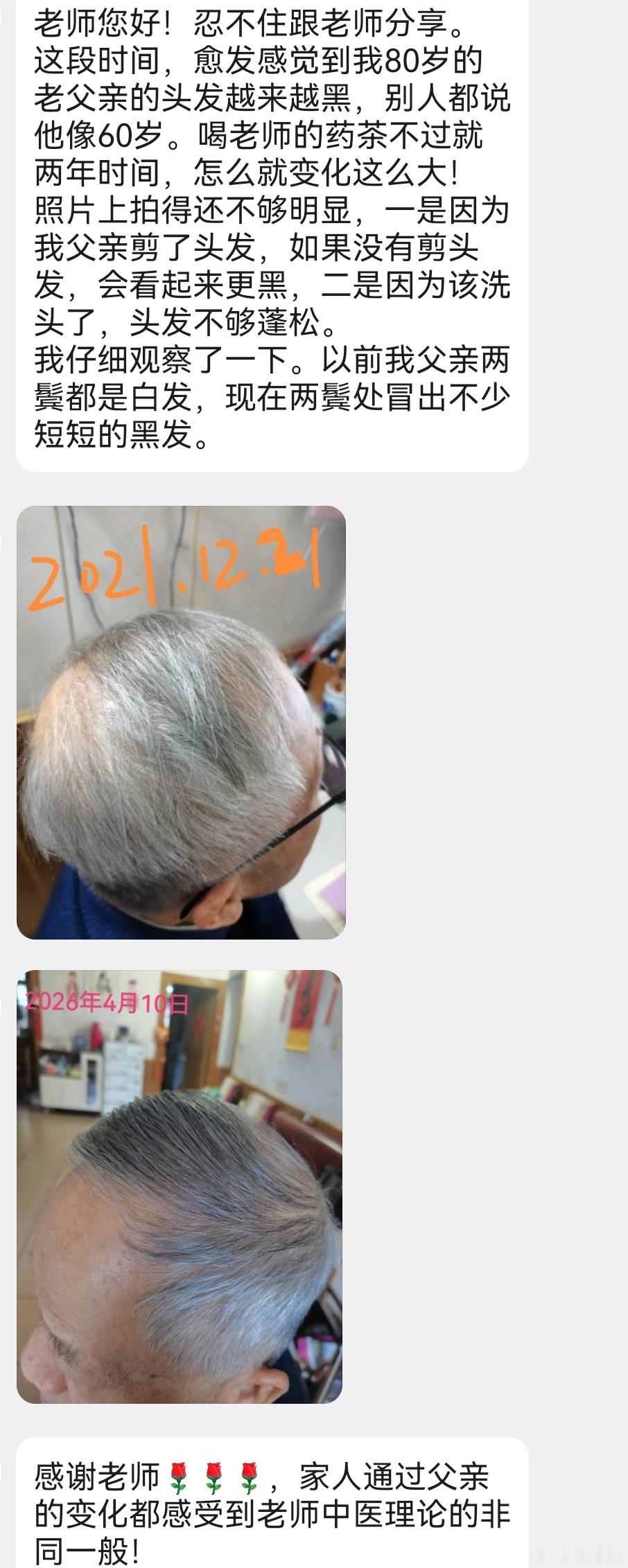 坚持按照邹时祯的中医理论进行调理，不到两年时间，老人的头发白转黑。邹时祯的中医理