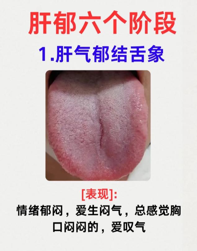 肝郁发展的六个阶段，越早调理越轻松