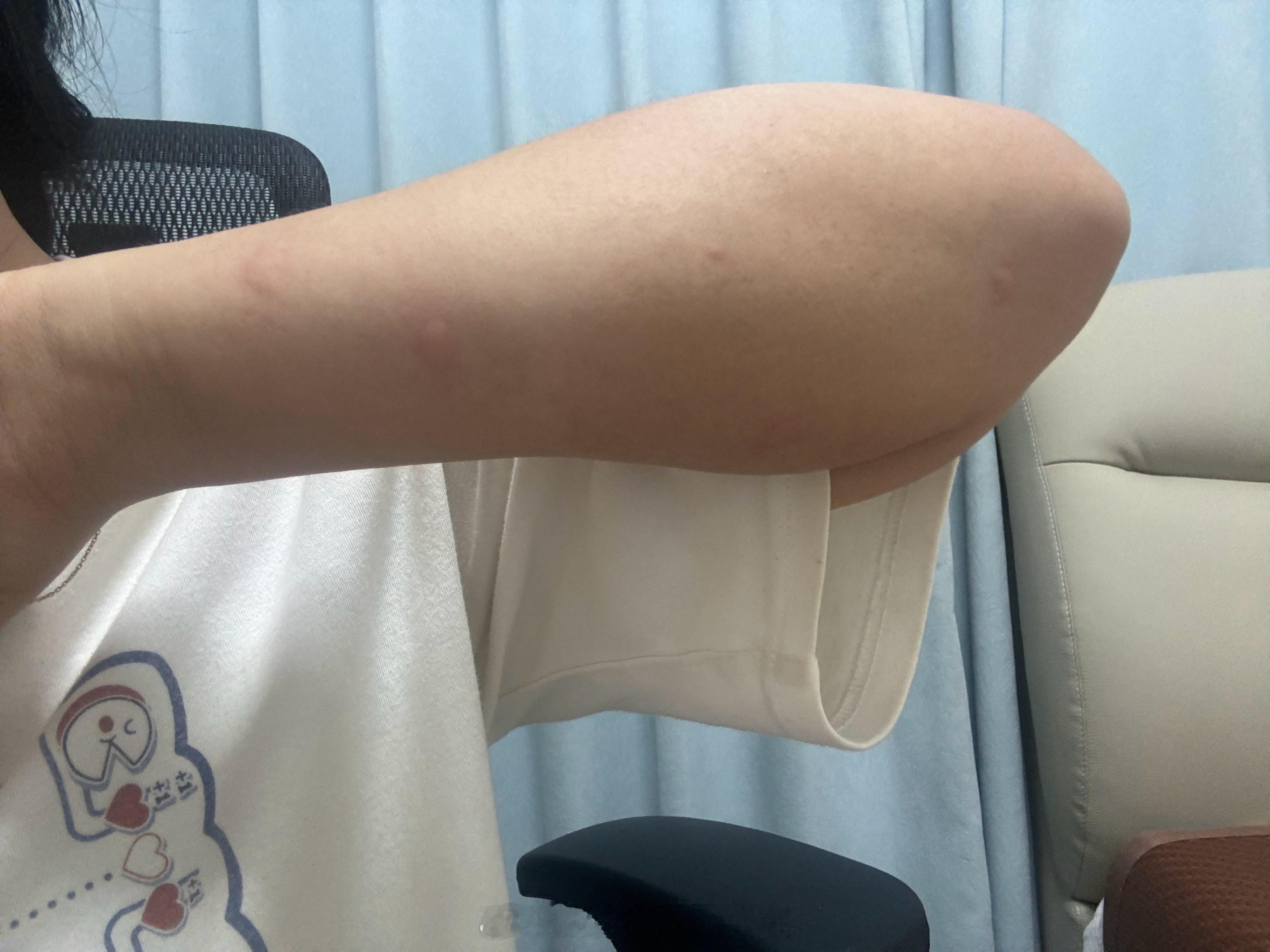 出门被蚊子奖励 