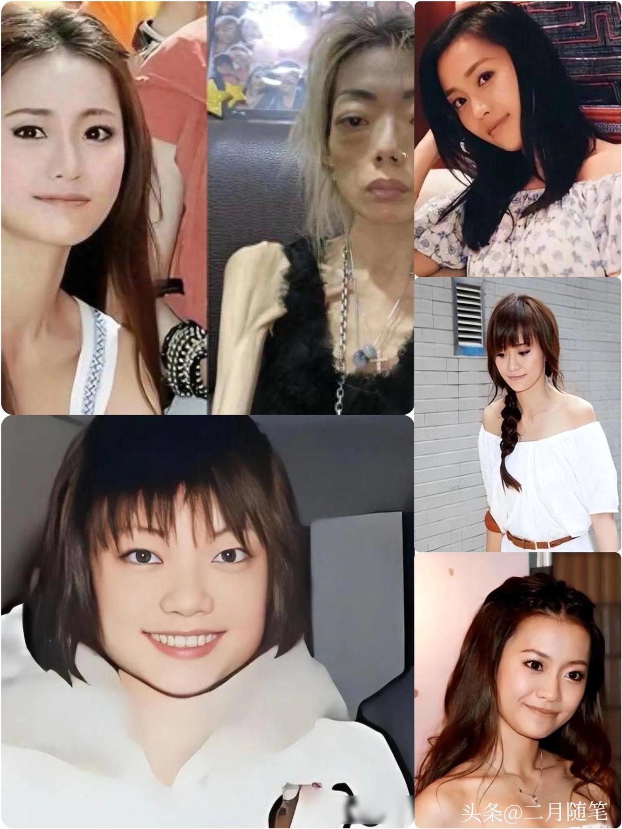 结婚8年
牙齿全掉
器官切除、面似骷髅，伍智恒到底经历了啥？
 
人人都羡慕灰姑