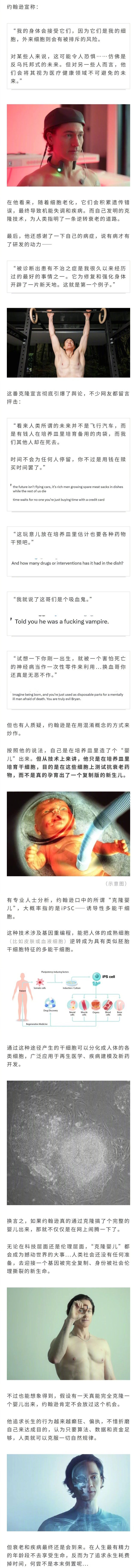 亿万富翁"换血哥"克隆婴儿当备用器官？要把婴儿拿来换血做实验，被拆穿是在夸大其词