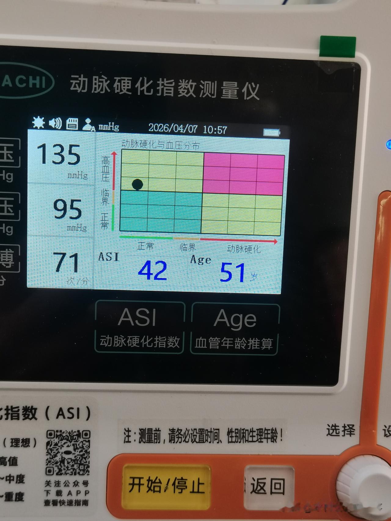 我的生理年龄比实际年龄年轻了5岁！
昨天去药店买药，导购美女一个劲儿劝我测量一下